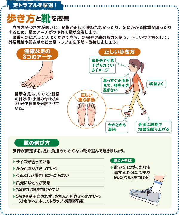 足トラブルと撃退！ 歩き方と靴を改善 立ち方や歩き方が悪いと、足指が正しく使われなかったり、足にかかる体重がかたよったりするため、足のアーチがつぶれて足が変形します。体重を足にバランスよくかけて立ち、足指や足裏の筋力を使う、正しい歩き方をして、外反母趾や巻き爪などの足トラブルを予防・改善しましょう。 靴の選び方 歩行が安定する、足に負担がかからない靴を選んで履きましょう。