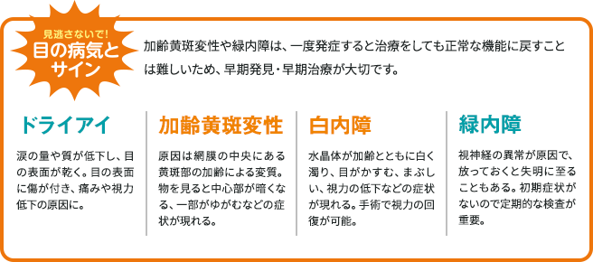見逃さないで！目の病気とサイン ドライアイ 加齢黄斑変性 白内障 緑内障