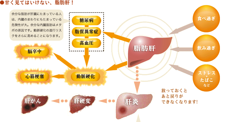 甘く見てはいけない、脂肪肝！