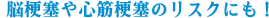 脳梗塞や心筋梗塞のリスクにも！