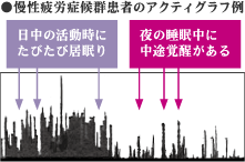 慢性疲労症候群患者のアクティグラフ例