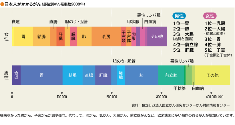 日本人がかかるがんの表