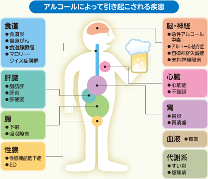 イラスト