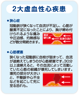 2大虚血性心疾患