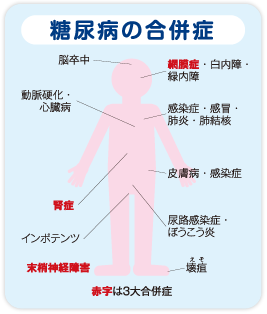 糖尿病の合併症