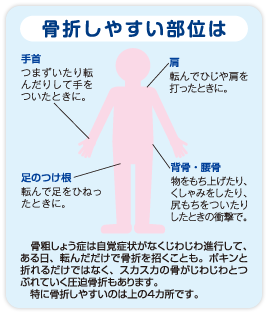 骨折しやすい部分は