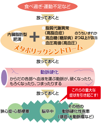 食べ過ぎ・運動不足など